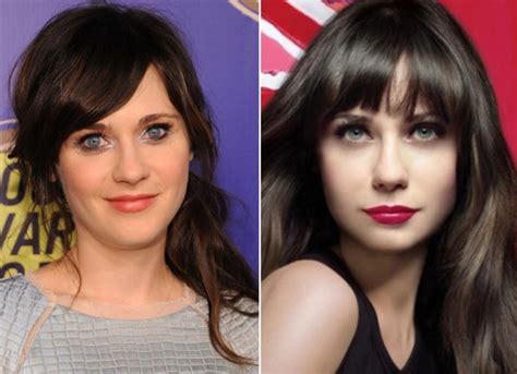 Zooey Deschanels plastic surgery